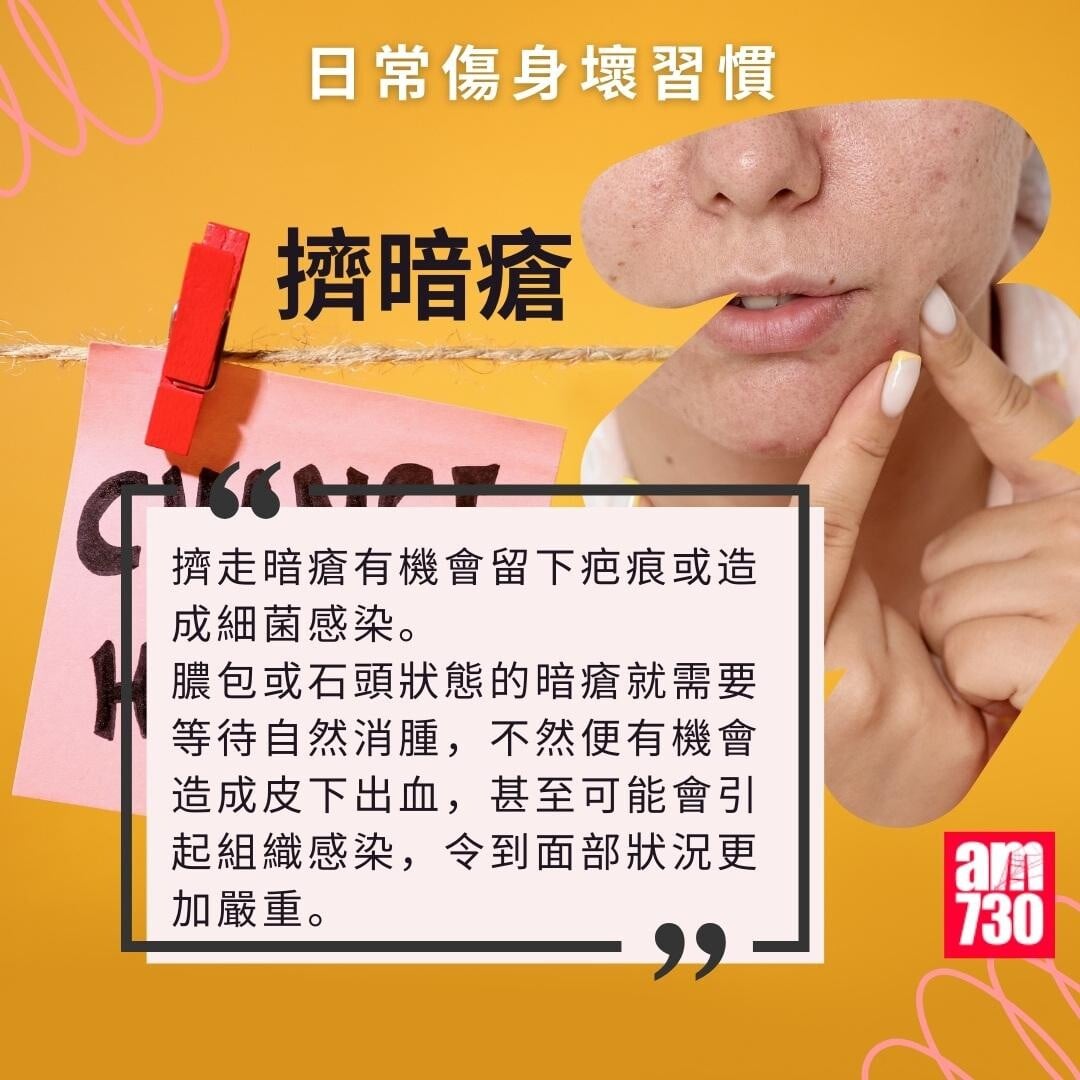  日常傷身壞習慣｜擠暗瘡（am730製圖）